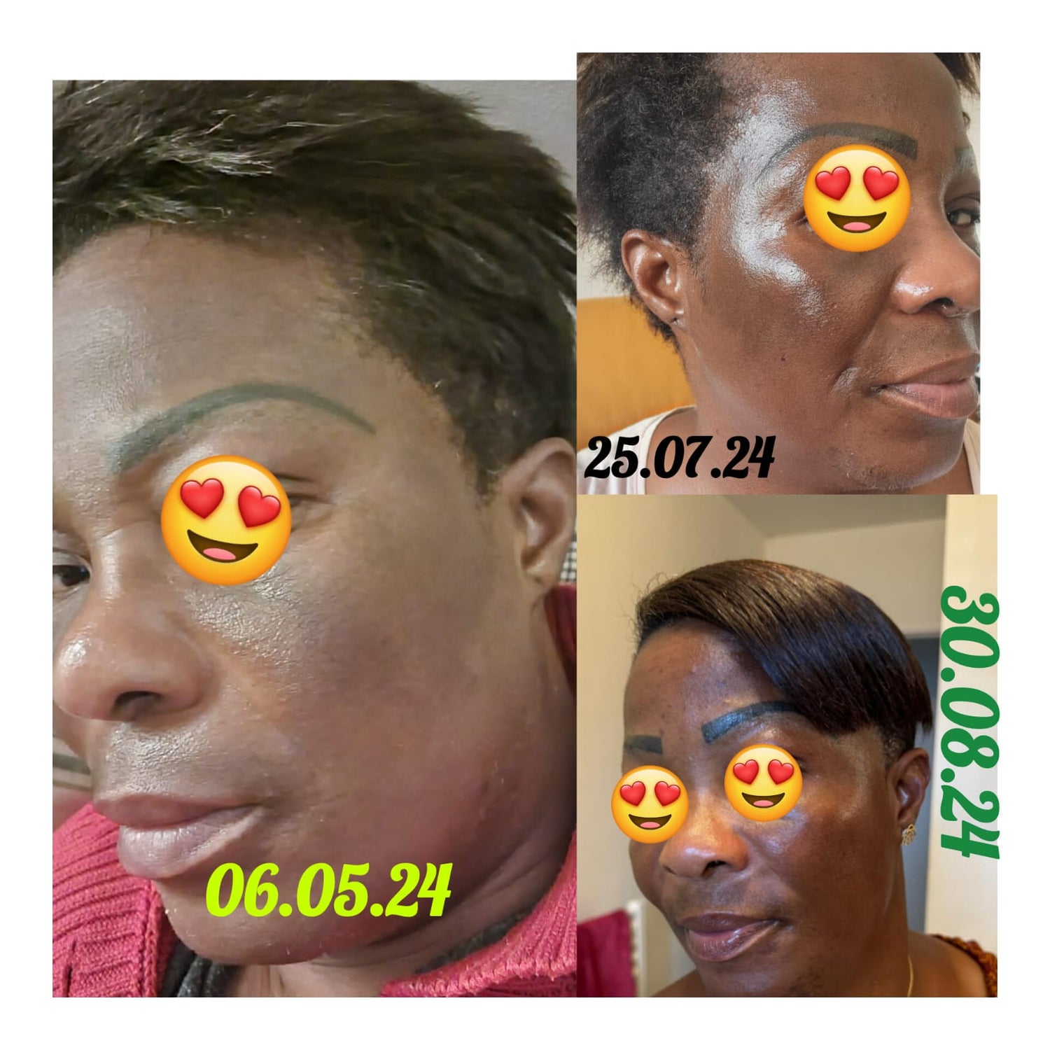 MELA REPAIR KIT PHARES – TRAITEMENT VISAGE ULTIME ANTI-TACHES & ANTI-MELASMA 5PCS