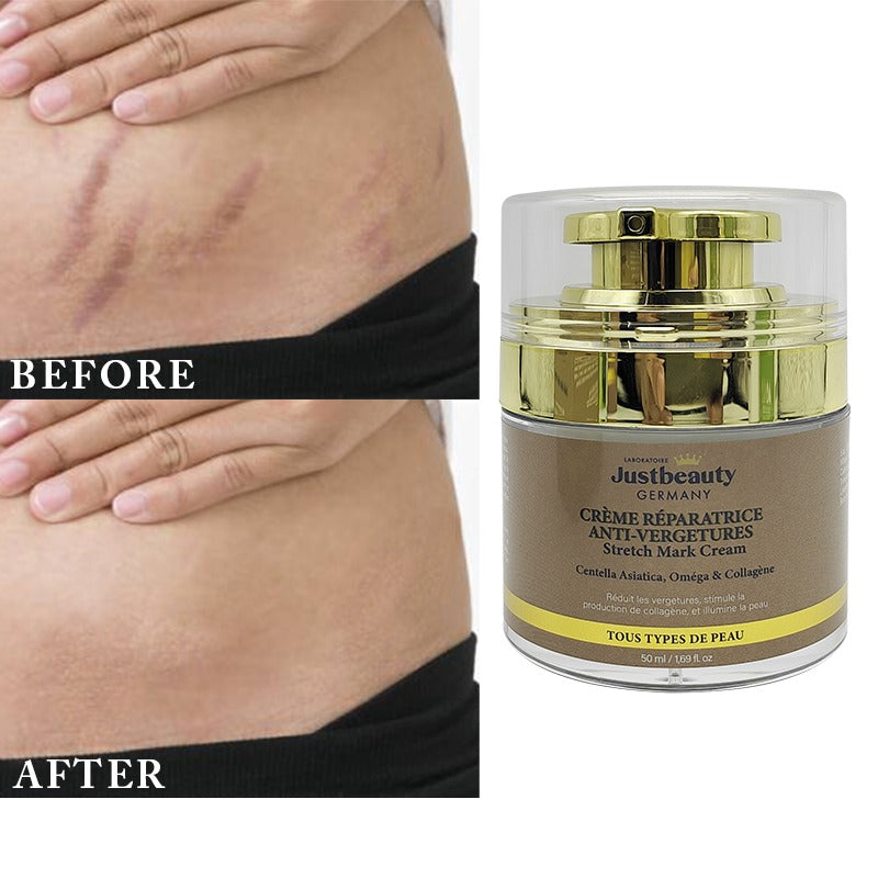 DUO EXPERT ANTI-VERGETURES