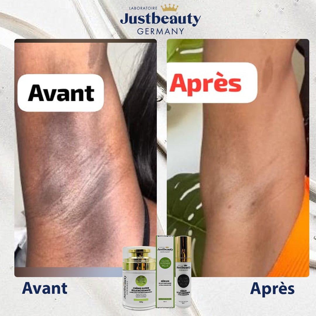 DUO ZONES SOMBRES – CRÈME + SÉRUM ÉCLAIRCISSANTS