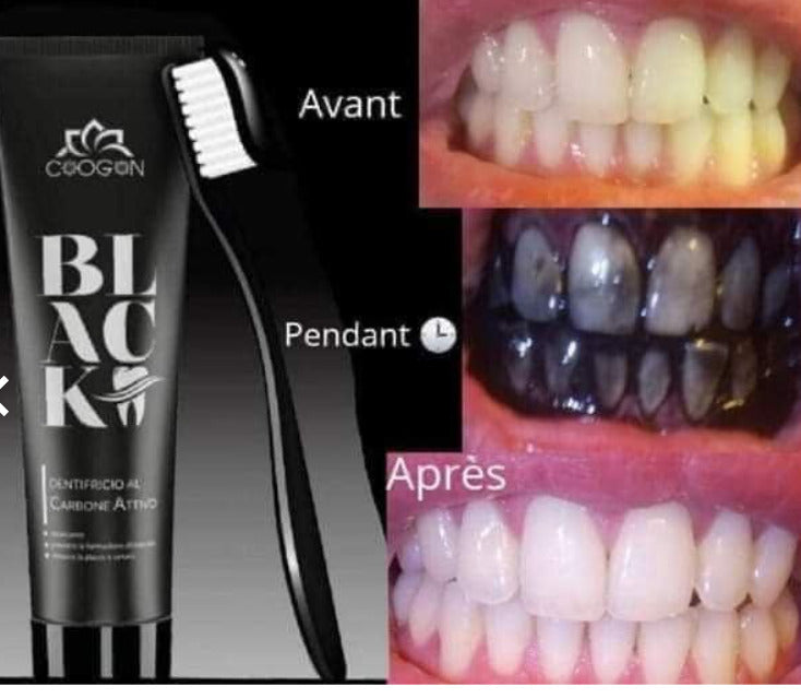 Dentifrice Ultra White au Charbon Actif 115g